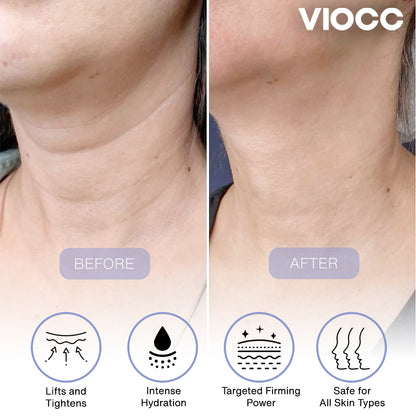 VIOCC™ Tighten & Lift Neck Cream