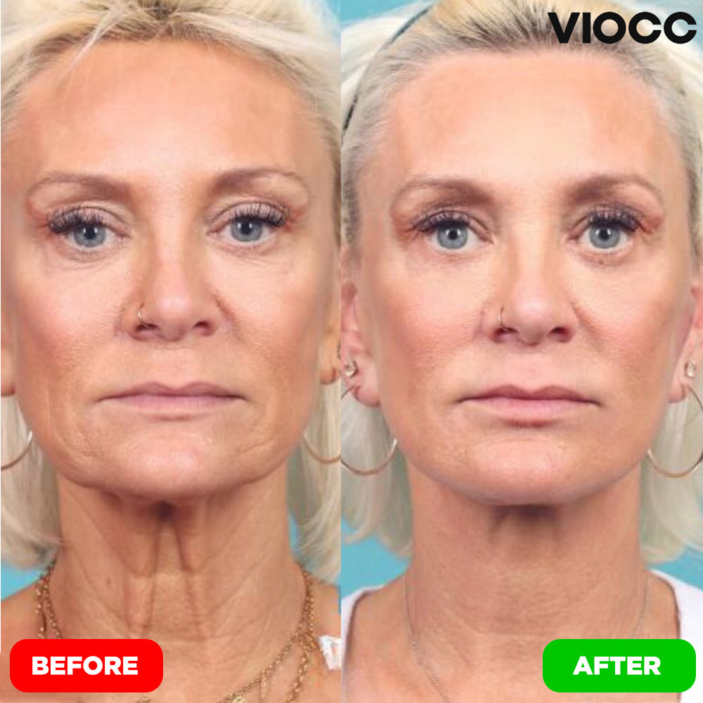 VIOCC™ Tighten & Lift Neck Cream