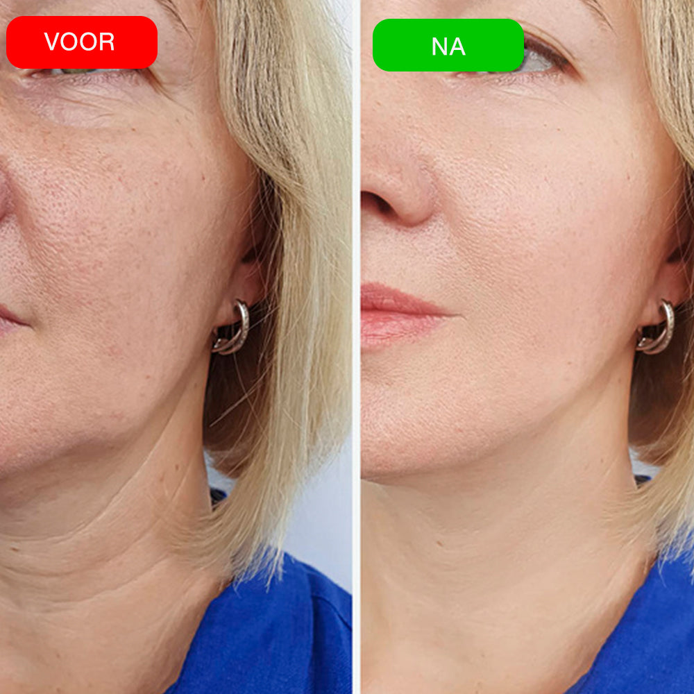 VIOCC™ Bio-Collageen Echt Diep Masker (Dutch)