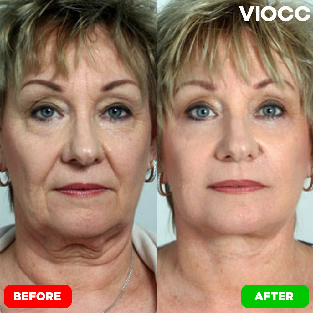 VIOCC™ Tighten & Lift Neck Cream