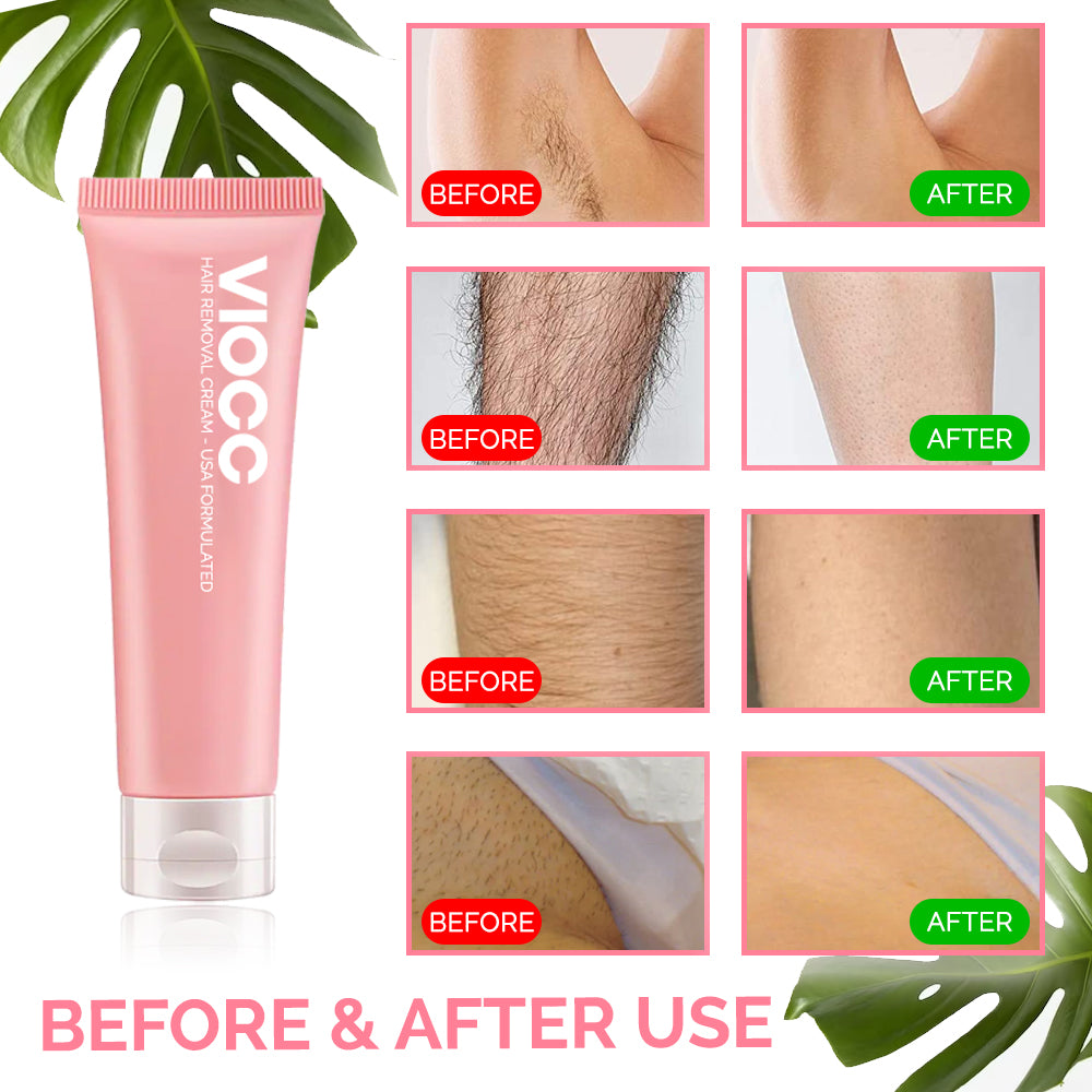 VIOCC™ Hair Removal Cream
