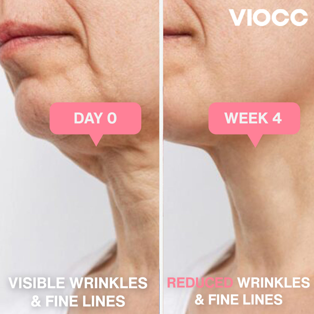 VIOCC™ Bio-Collagen Hydrating Neck Mask