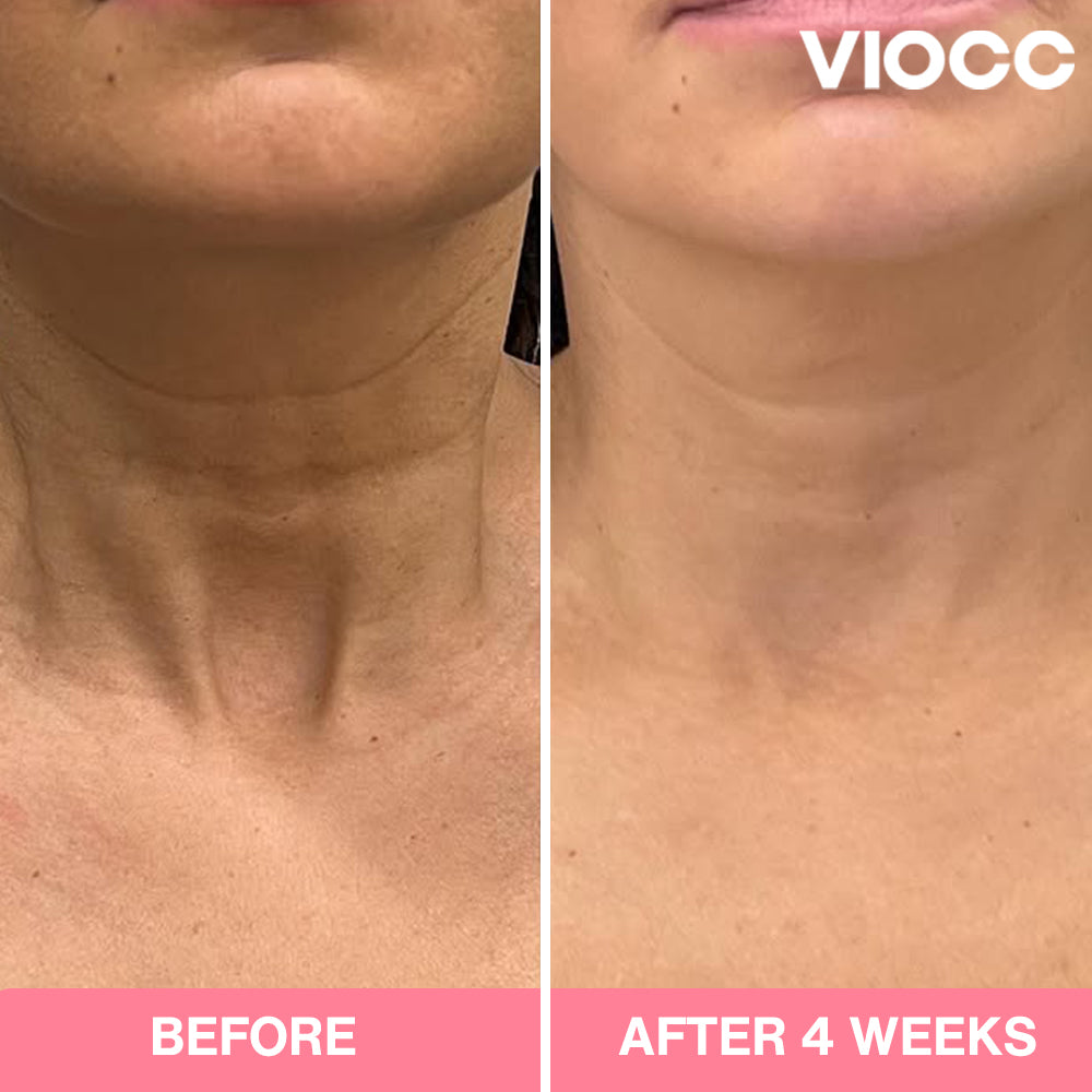 VIOCC™ Bio-Collagen Hydrating Neck Mask