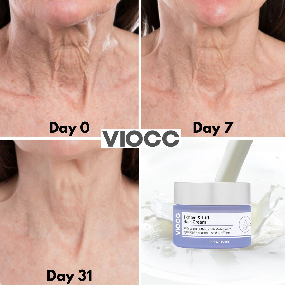 VIOCC™ Tighten & Lift Neck Cream