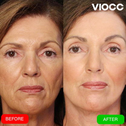 VIOCC™ FirmGlow Collagen 5D Lifting Mask