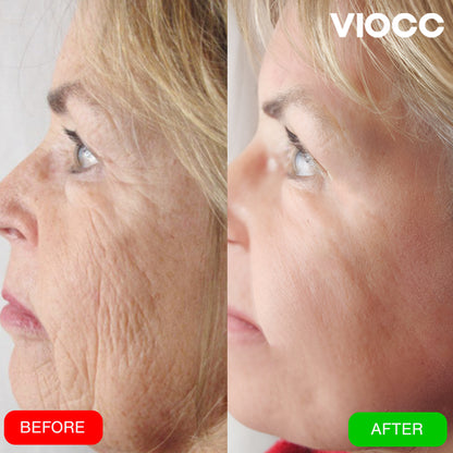 VIOCC™ FirmGlow Collagen 5D Lifting Mask