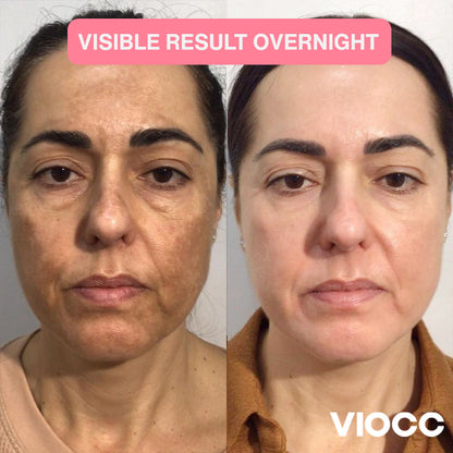 VIOCC™ FirmGlow Collagen 5D Lifting Mask