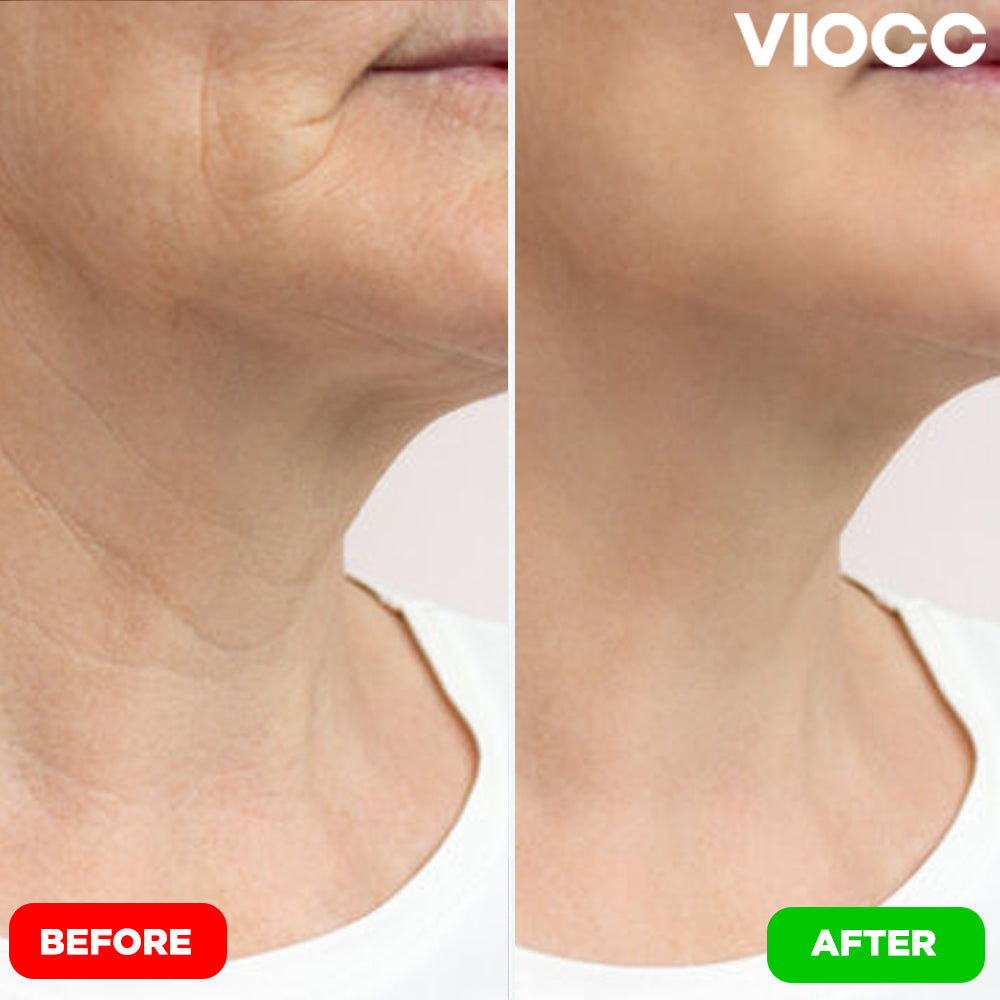 VIOCC™ Tighten & Lift Neck Cream