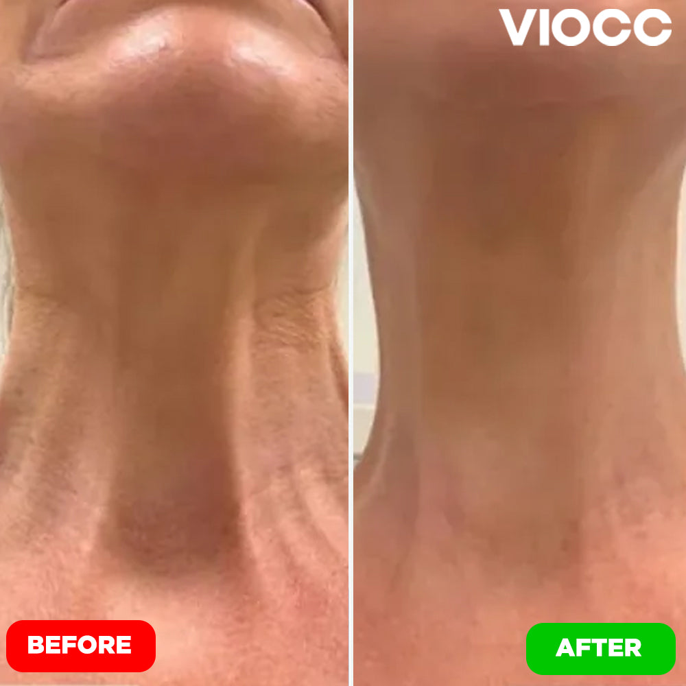 VIOCC™ Tighten & Lift Neck Cream