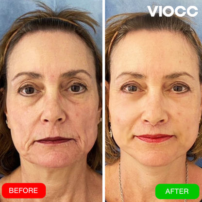 VIOCC™ Glow Collagen Facial Mask