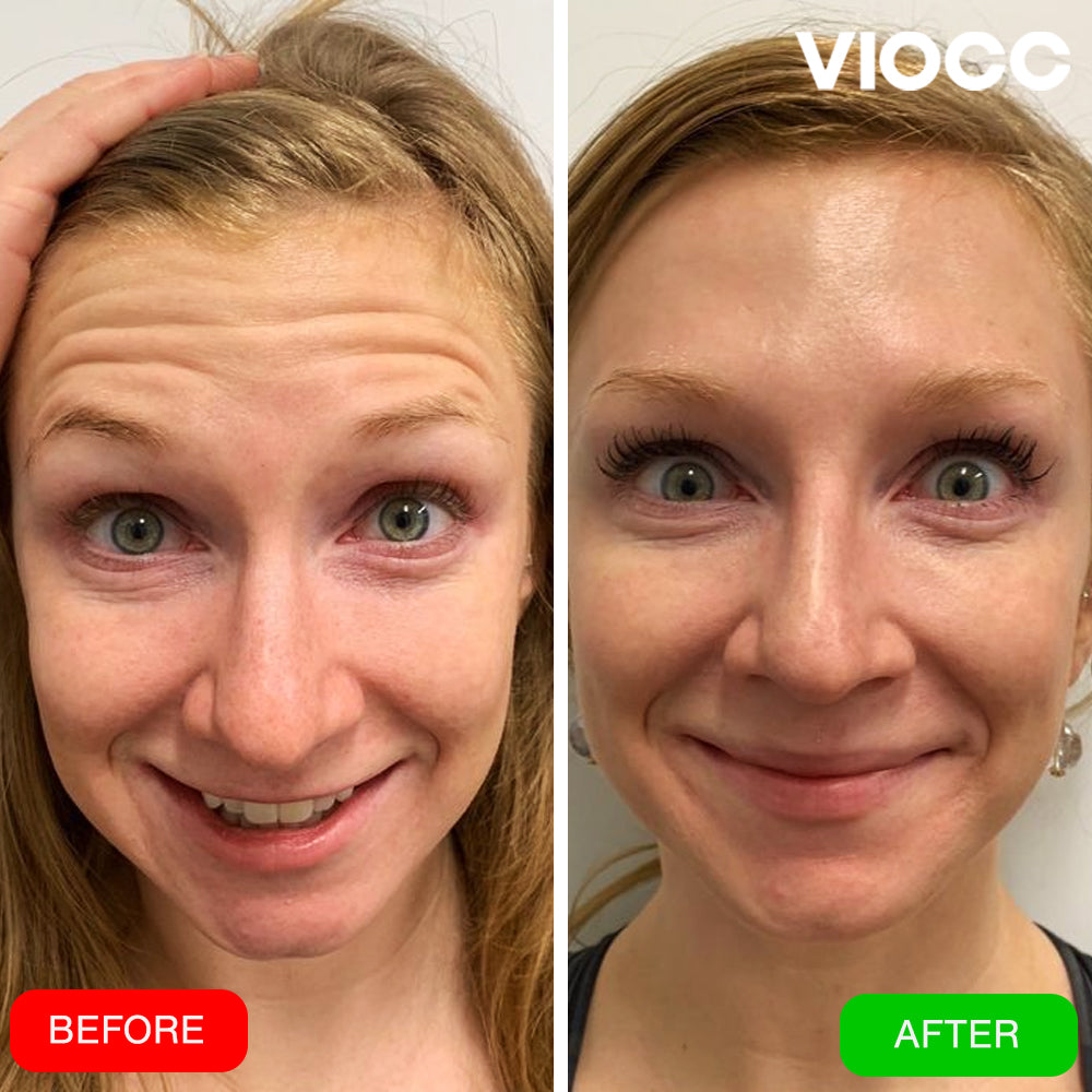 VIOCC™ Glow Collagen Facial Mask